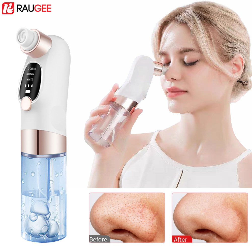 にきび除去電気にきび抽出器毛穴掃除機マイクロ小さな泡にきび鼻 - Air Bubble Remover のレビューと価格