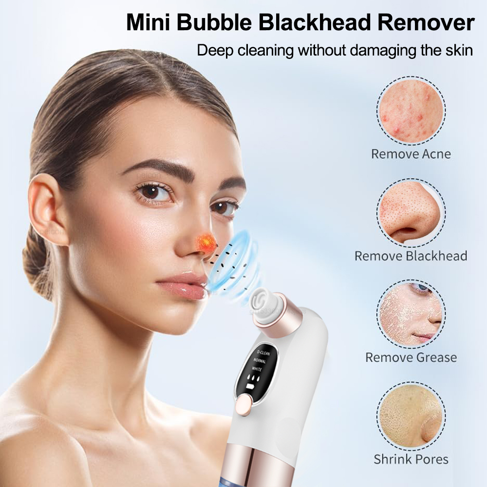にきび除去電気にきび抽出器毛穴掃除機マイクロ小さな泡にきび鼻 - Air Bubble Remover のレビューと価格